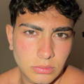 Erik Hayrapetyan – Foto 13